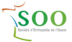 SOO